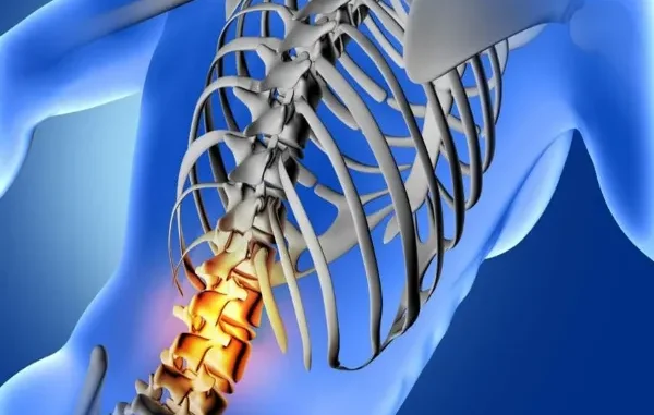 Avoiding Spinal Injury Claim Mistakes A digital illustration of a human spine and ribcage, with the lower spinal vertebrae highlighted in bright orange, indicating a spinal injury.