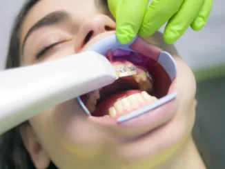 A close-up view of a person's open mouth with a cheek retractor in place, revealing the lower and upper teeth with braces, while a hand in a neon green glove holds a scanning device or dental tool near the upper teeth.