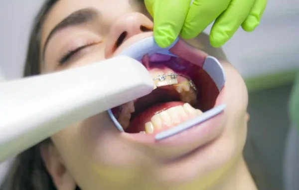 The Foundation of Your Smile: Prioritizing Gum Health with Your Dentist A close-up view of a person's open mouth with a cheek retractor in place, revealing the lower and upper teeth with braces, while a hand in a neon green glove holds a scanning device or dental tool near the upper teeth.