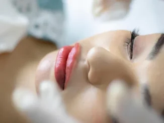A close-up, high-angle shot of a woman lying with her eyes closed, receiving a cosmetic or aesthetic treatment, with gloved hands visible in the foreground.